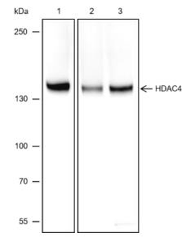 HDAC4 Recombinant Rabbit Monoclonal Antibody