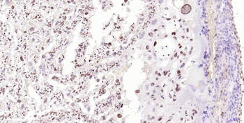 Phospho-H2AX (Ser139) Recombinant Rabbit Monoclonal Antibody