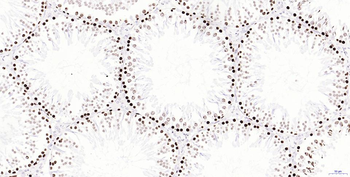 Phospho-H2AX (Ser139) Recombinant Rabbit Monoclonal Antibody