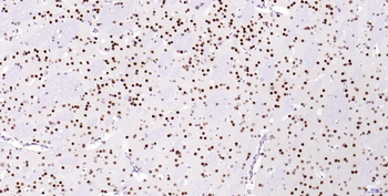 Phospho-H2AX (Ser139) Recombinant Rabbit Monoclonal Antibody