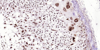 Phospho-H2AX (Ser139) Recombinant Rabbit Monoclonal Antibody