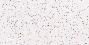 Phospho-H2AX (Ser139) Recombinant Rabbit Monoclonal Antibody