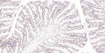 Phospho-H2AX (Ser139) Recombinant Rabbit Monoclonal Antibody