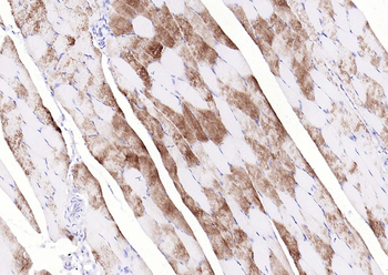 Phospho-Glycogen synthase 1 (Ser641) Recombinant Rabbit Monoclonal Antibody