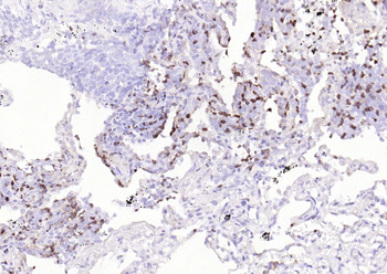 Phospho-Glycogen synthase 1 (Ser641) Recombinant Rabbit Monoclonal Antibody