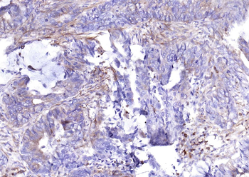 Phospho-Glycogen synthase 1 (Ser641) Recombinant Rabbit Monoclonal Antibody