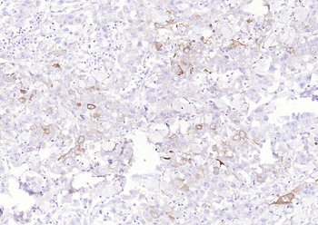 Phospho-Glycogen synthase 1 (Ser641) Recombinant Rabbit Monoclonal Antibody