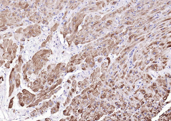 Phospho-Glycogen synthase 1 (Ser641) Recombinant Rabbit Monoclonal Antibody