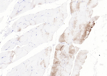 Phospho-Glycogen synthase 1 (Ser641) Recombinant Rabbit Monoclonal Antibody