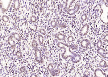 Phospho-Estrogen Receptor alpha (Ser118) Recombinant Rabbit Monoclonal Antibody