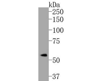 Phospho-Estrogen Receptor alpha (Ser118) Recombinant Rabbit Monoclonal Antibody