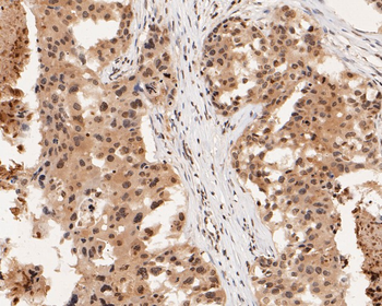 Phospho-Estrogen Receptor alpha (Ser118) Recombinant Rabbit Monoclonal Antibody