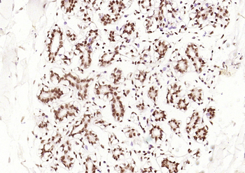 Phospho-Estrogen Receptor alpha (Ser118) Recombinant Rabbit Monoclonal Antibody
