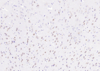 Phospho-eIF4E (Ser209) Recombinant Rabbit Monoclonal Antibody