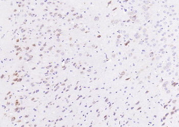 Phospho-eIF4E (Ser209) Recombinant Rabbit Monoclonal Antibody