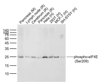 Phospho-eIF4E (Ser209) Recombinant Rabbit Monoclonal Antibody
