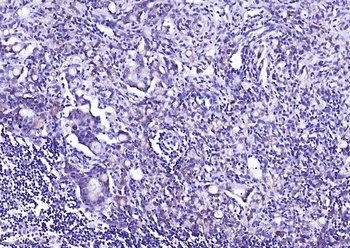 Phospho-EGFR (Ser695) Recombinant Rabbit Monoclonal Antibody