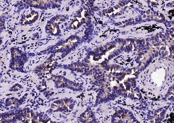 Phospho-EGFR (Ser695) Recombinant Rabbit Monoclonal Antibody
