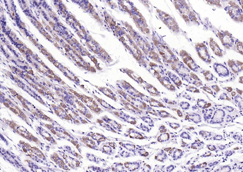 Phospho-EGFR (Ser695) Recombinant Rabbit Monoclonal Antibody