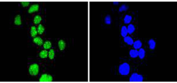 Phospho-Cyclin E1 (Thr77) Recombinant Rabbit Monoclonal Antibody