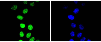 Phospho-Cyclin E1 (Thr77) Recombinant Rabbit Monoclonal Antibody