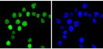 Phospho-Cyclin E1 (Thr77) Recombinant Rabbit Monoclonal Antibody
