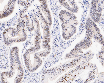 Phospho-Cyclin E1 (Thr77) Recombinant Rabbit Monoclonal Antibody