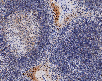 Phospho-Cyclin E1 (Thr77) Recombinant Rabbit Monoclonal Antibody