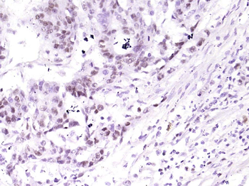 Phospho-C-Myc (Ser62) Recombinant Rabbit Monoclonal Antibody