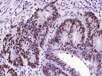 Phospho-C-Myc (Ser62) Recombinant Rabbit Monoclonal Antibody