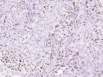 Phospho-C-Myc (Ser62) Recombinant Rabbit Monoclonal Antibody