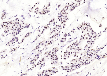 Phospho-c-Jun (Ser63) Recombinant Rabbit Monoclonal Antibody
