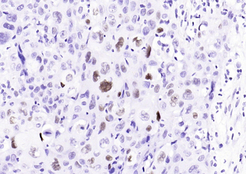 Phospho-c-Jun (Ser63) Recombinant Rabbit Monoclonal Antibody