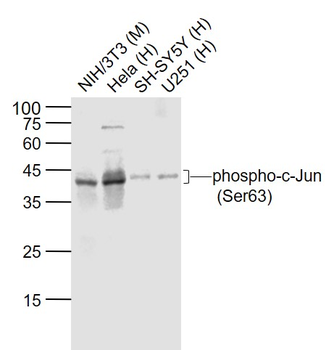 Phospho-c-Jun (Ser63) Recombinant Rabbit Monoclonal Antibody