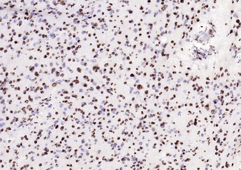 Phospho-SMAD5 (Ser463 + Ser465) Recombinant Rabbit Monoclonal Antibody