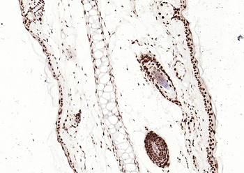 Phospho-SMAD5 (Ser463 + Ser465) Recombinant Rabbit Monoclonal Antibody