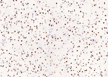 Phospho-SMAD5 (Ser463 + Ser465) Recombinant Rabbit Monoclonal Antibody