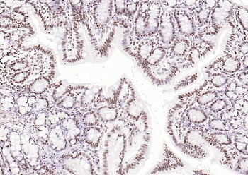 Phospho-SMAD5 (Ser463 + Ser465) Recombinant Rabbit Monoclonal Antibody