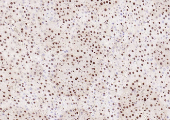Phospho-SMAD5 (Ser463 + Ser465) Recombinant Rabbit Monoclonal Antibody