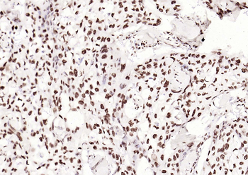 Phospho-SMAD5 (Ser463 + Ser465) Recombinant Rabbit Monoclonal Antibody