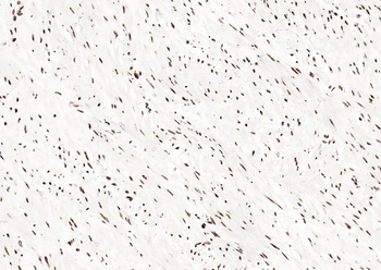 Phospho-SMAD5 (Ser463 + Ser465) Recombinant Rabbit Monoclonal Antibody