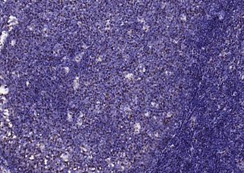Phospho-SMAD5 (Ser463 + Ser465) Recombinant Rabbit Monoclonal Antibody