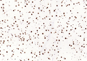 Phospho-SMAD5 (Ser463 + Ser465) Recombinant Rabbit Monoclonal Antibody