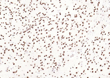 Phospho-SMAD5 (Ser463 + Ser465) Recombinant Rabbit Monoclonal Antibody