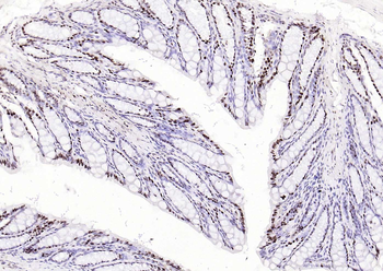 Phospho-SMAD5 (Ser463 + Ser465) Recombinant Rabbit Monoclonal Antibody