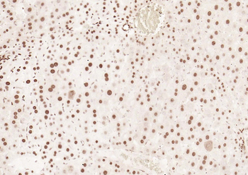 Phospho-SMAD5 (Ser463 + Ser465) Recombinant Rabbit Monoclonal Antibody