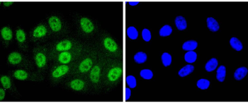 Phospho-SIRT1 (Thr530) Recombinant Rabbit Monoclonal Antibody