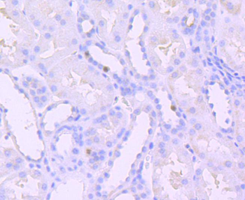 Phospho-SIRT1 (Thr530) Recombinant Rabbit Monoclonal Antibody
