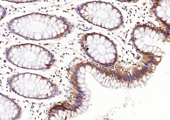 Phospho-RPS6KA1 (Ser380) Recombinant Rabbit Monoclonal Antibody