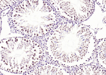 Phospho-RPS6KA1 (Ser380) Recombinant Rabbit Monoclonal Antibody